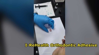 Ортодонтическая бондинговая система