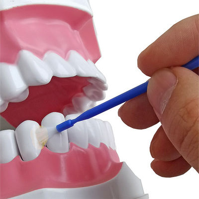 политура фторида 10g 5%NaF применяется к remineralization зуба и CE костоеды Prevebts
